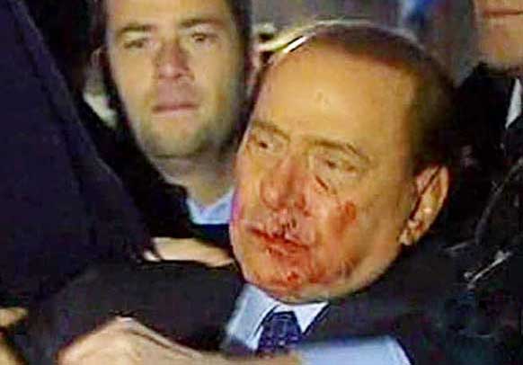 berlusconi_aggressione10