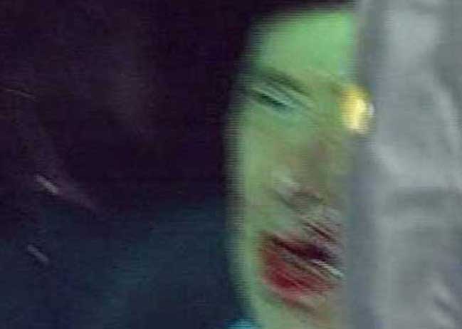 berlusconi_aggressione2