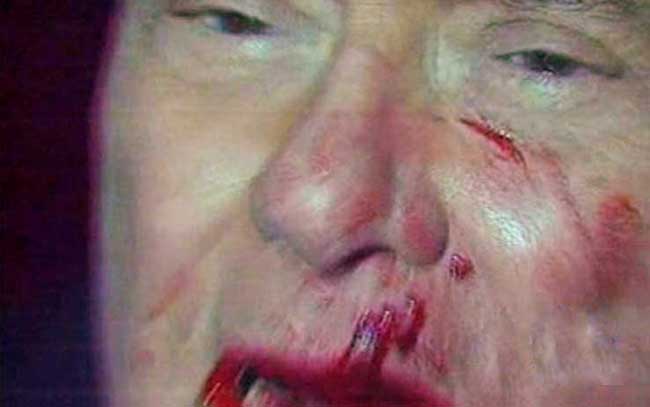 berlusconi_aggressione5