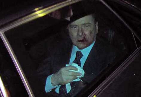 berlusconi_aggressione6